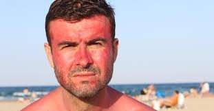 حروق الشمس: ليست مجرد إزعاج بل خطر طويل الأمد