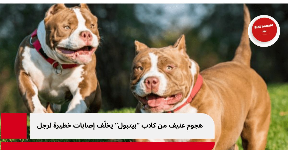 هجوم عنيف من كلاب “بيتبول” يخلّف إصابات خطيرة لرجل