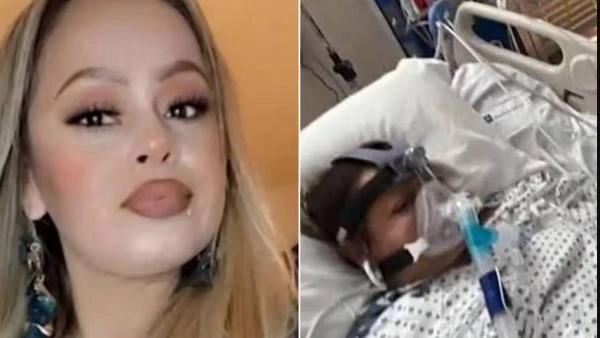 بتر أطراف أمريكية بعد تناول سمك