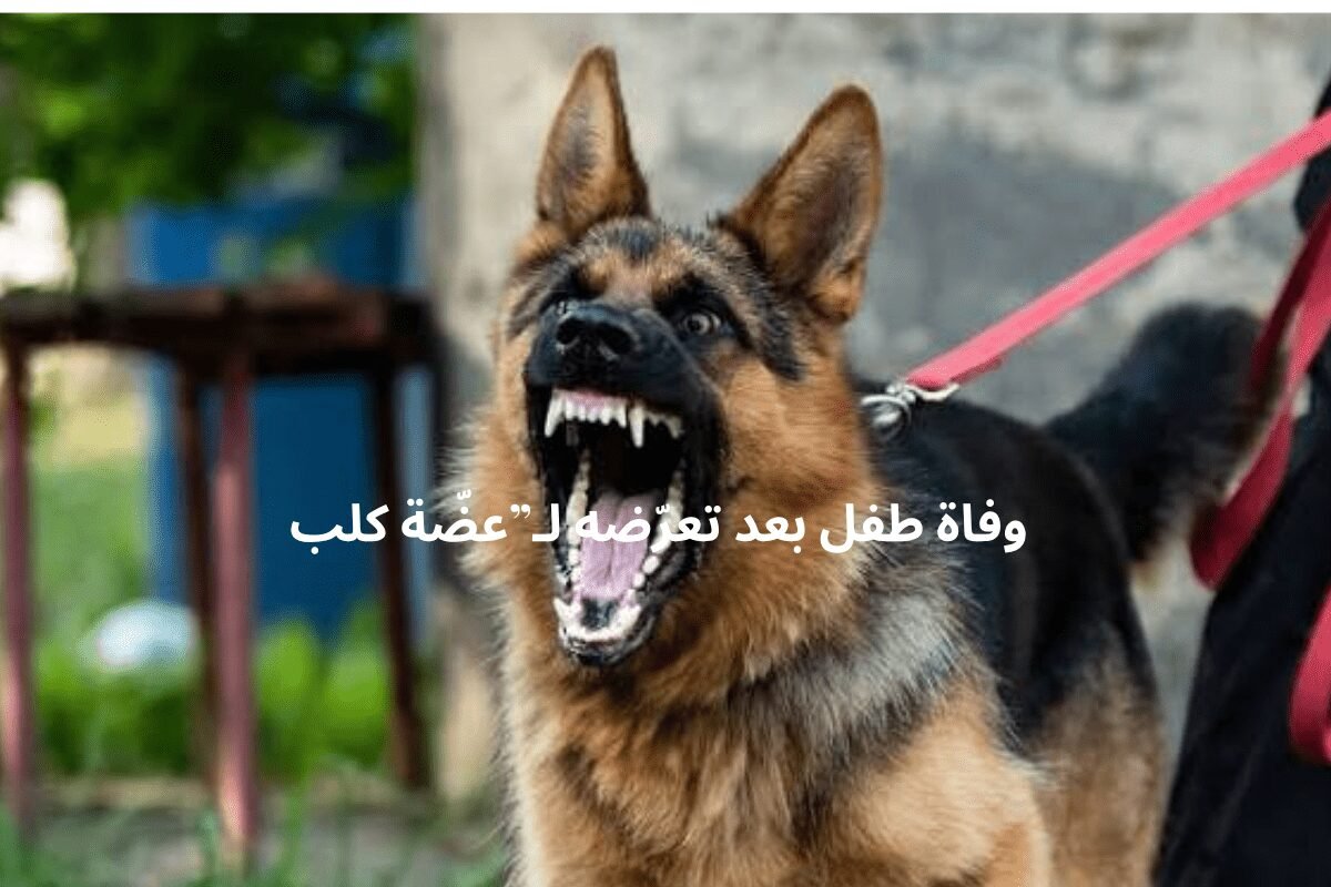 وفاة طفل بعد تعرّضه لـ”عضّة كلب